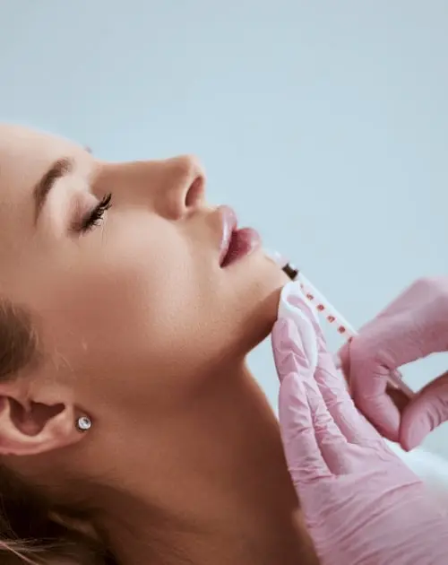 Smithville Smiles | Dermafill in NJ
